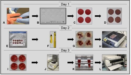 貝斯特采血卡采樣流程